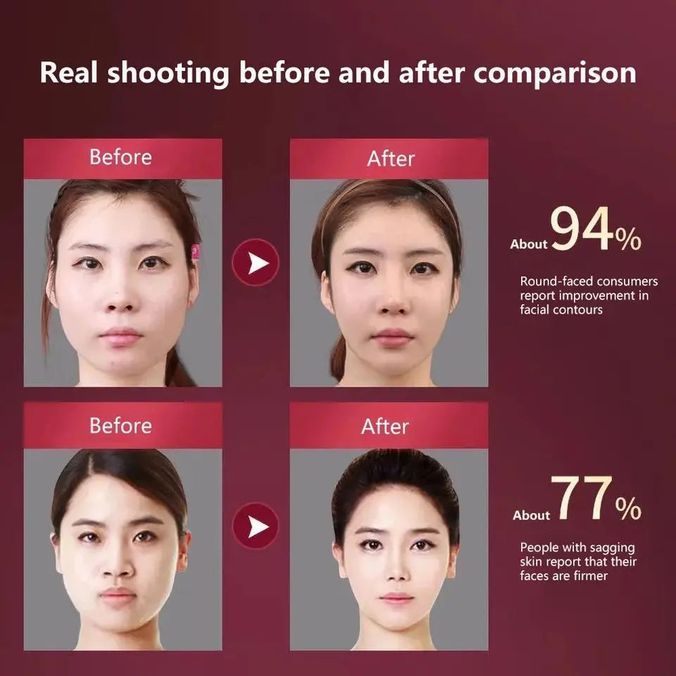 Dispositivo de levantamento facial led fóton terapia facial emagrecimento vibração massageador facial aquecido queixo duplo v rosto vibração massageador