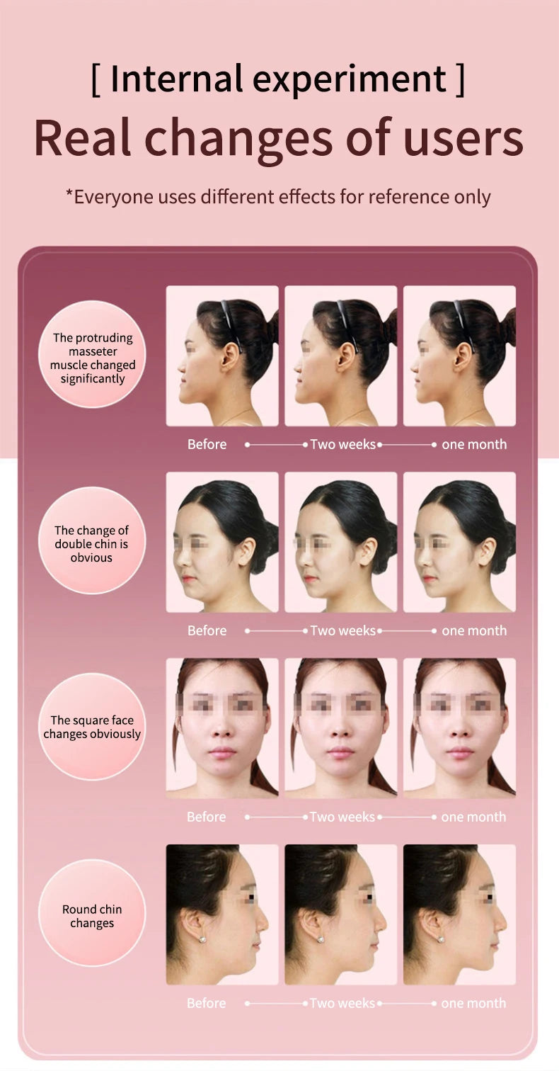 Dispositivo de levantamento facial led fóton terapia facial emagrecimento vibração massageador facial aquecido queixo duplo v rosto vibração massageador